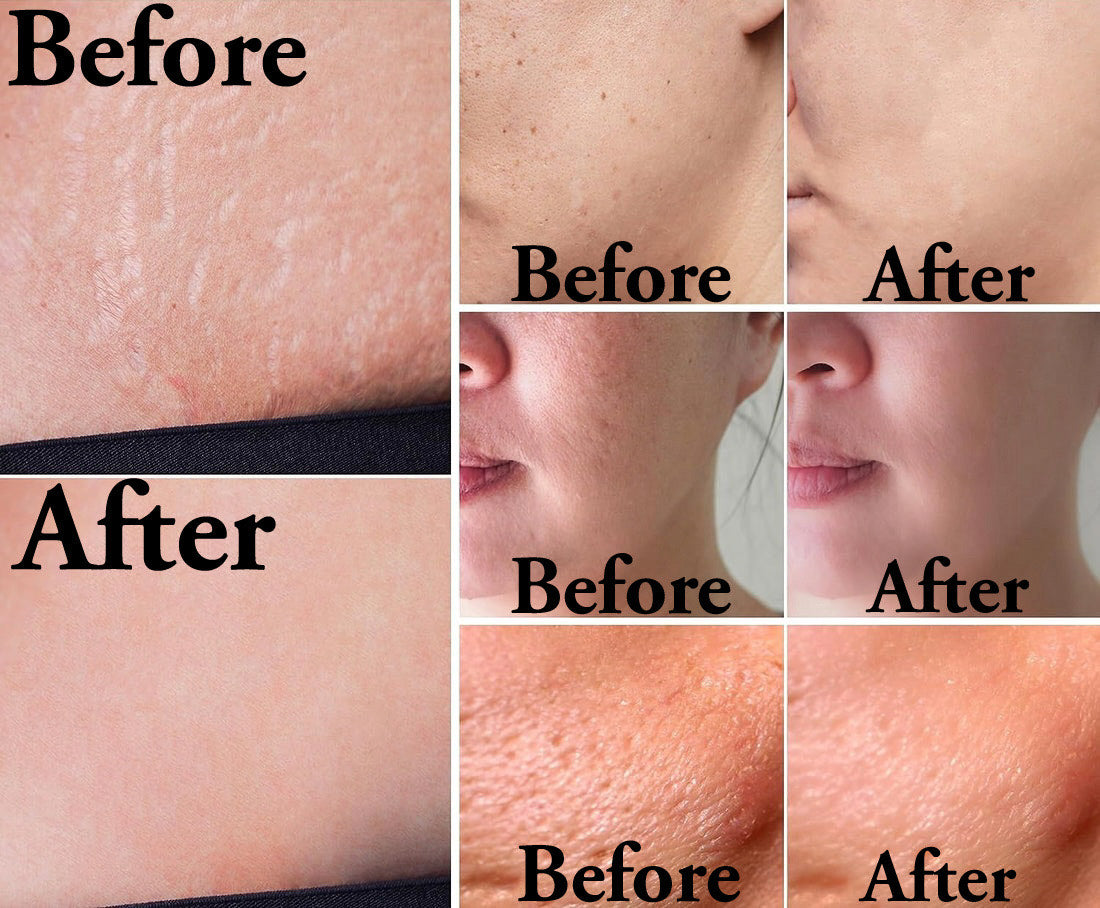 Adaptive DermaStamp™