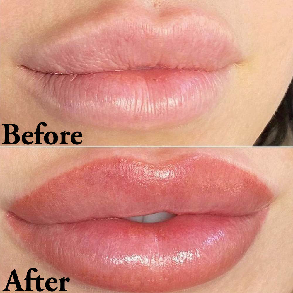 Adaptive DermaStamp™